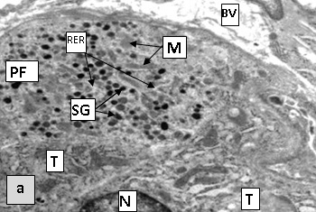 Figure 1a. Areas of the thyroid in sexually mature rats