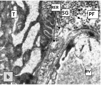 Figure 1b. Areas of the thyroid in sexually mature rats