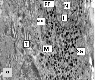 Figure 2a. Areas of the thyroid in sexually mature rats