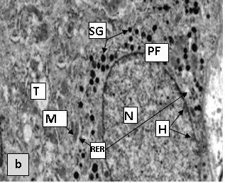 Figure 2b. Areas of the thyroid in sexually mature rats